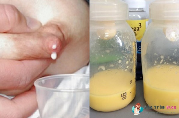 Có nên vắt sữa non trước sinh?