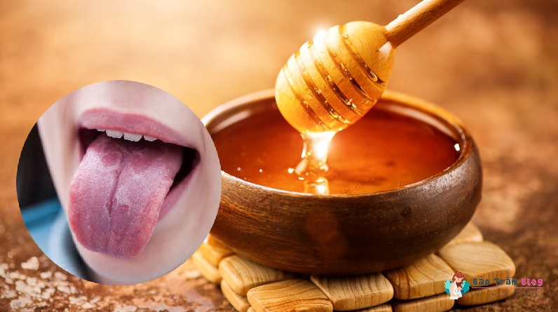 Có nên rơ lưỡi cho trẻ bằng mật ong?