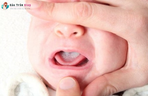 Top 5 gạc rơ lưỡi cho trẻ sơ sinh tốt nhất và an toàn nhất